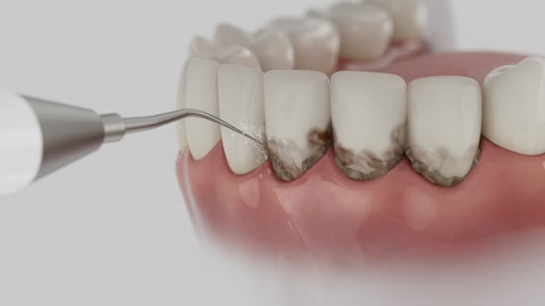Reliable Emergency Dentist contractor in Waverly, IL by Smile Center Dentistry